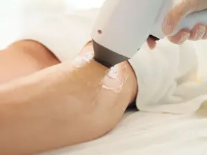 Handstück eines Geräts zur Haarreduktion am Unterarm, heller Behandlungsraum